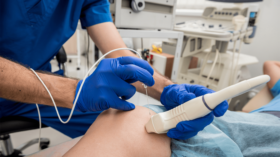 ADOBE cardiac abolation