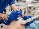 ADOBE cardiac abolation