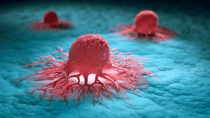ADOBE cancer tumour